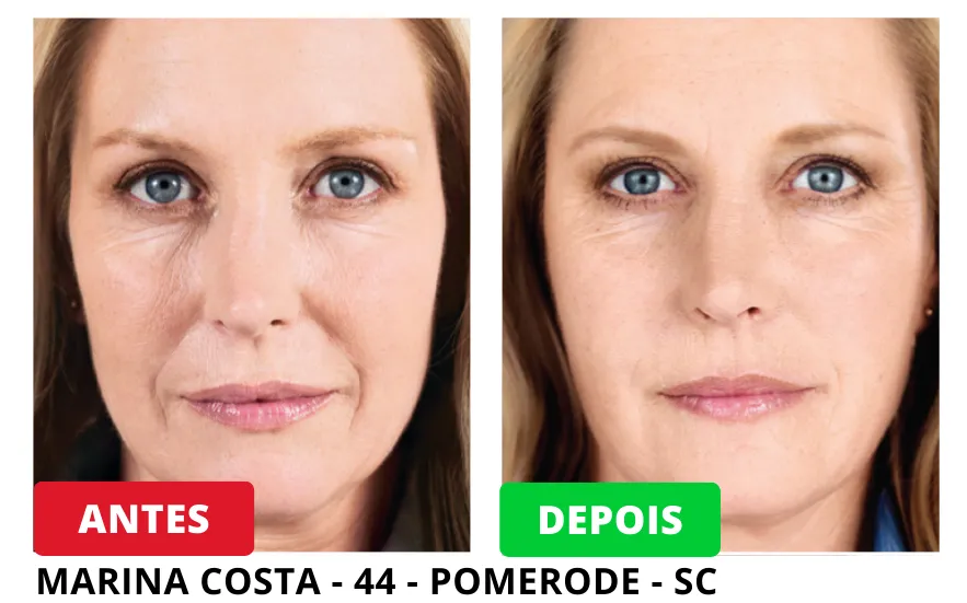 Resultados Antes e Depois