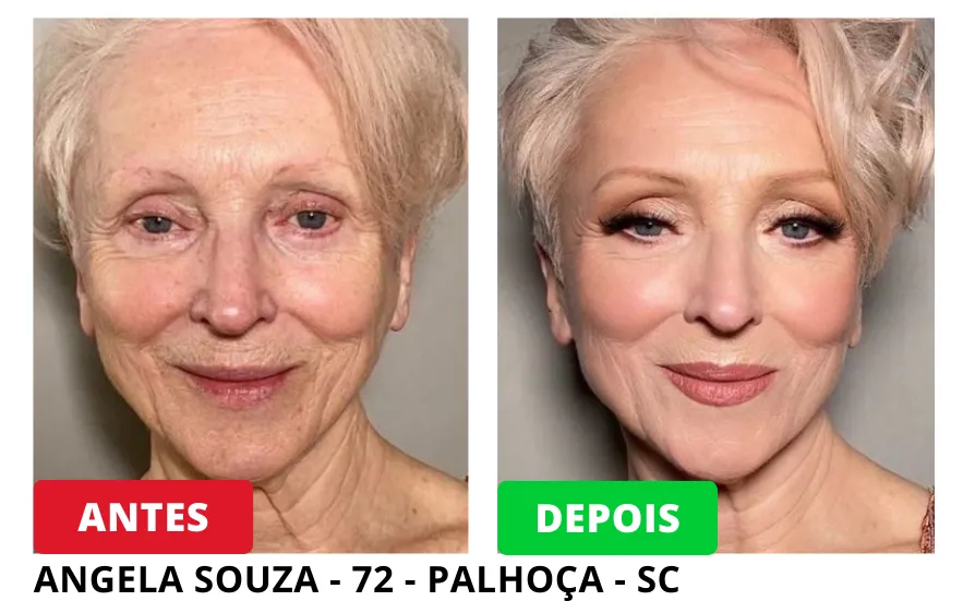 Resultados Antes e Depois